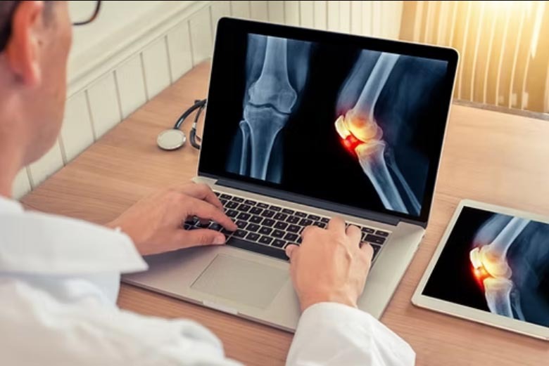 Le préjudice du déficit fonctionnel permanent ou la détermination des séquelles d&rsquo;une victime ?